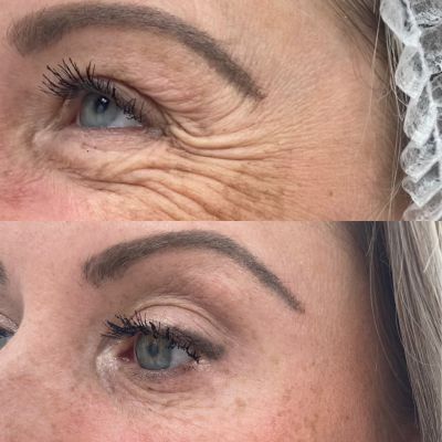 Результат работы, фото 8 — Esthetology