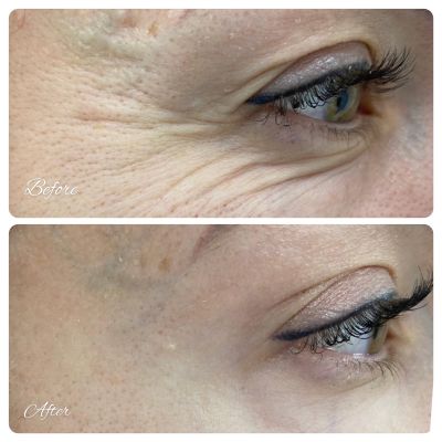 Результат работы , фото 11 — Esthetology