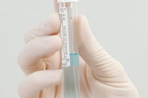 Мезотерапия от рубцов и растяжек, фото 10 — Esthetology